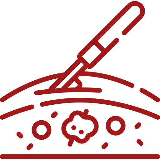 Cytoreductive Surgery (CRS)