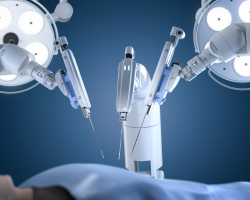 Benefits of Robotic Surgery